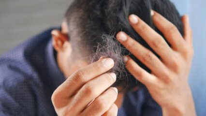 চুল পড়া বন্ধ করার উপায়